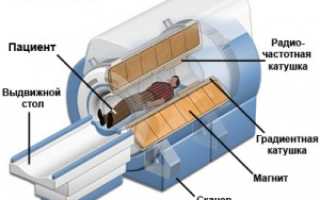 Мрт Что За Процедура и Как Она Проходит
