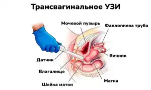 Узи Омс Что Это и Как Это Работает