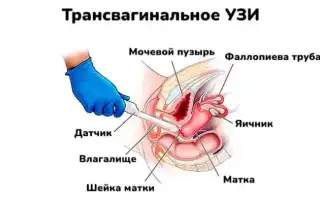 Узи Омс Что Это и Как Это Работает