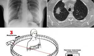 Что Такое Кт Снимок и Его Применение