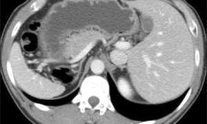 Скт Обп Что Это За Обследование и Его Значение