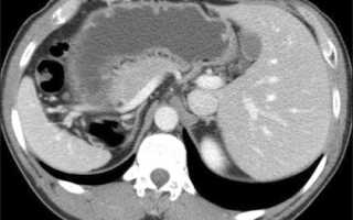 Скт Обп Что Это За Обследование и Его Значение