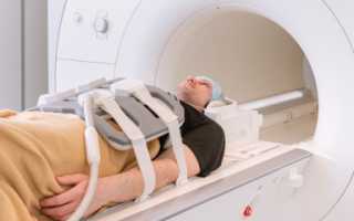 Обследование Мрт Что Это За Обследование и Как Оно Проходит