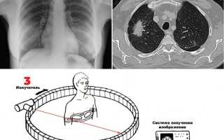 Что Такое Кт Диагностика и Её Применение