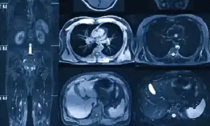 Кт Всего Организма Что Показывает: Полное Руководство