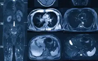 Кт Всего Организма Что Показывает: Полное Руководство