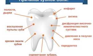 Сколько Можно Терпеть Зубную Боль Без Вреда Здоровью