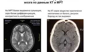 Что Лучше Кт Или Мрт Для Диагностики Здоровья