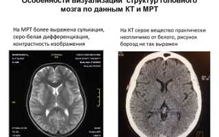Что Лучше Кт Или Мрт Для Диагностики Здоровья