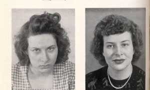 Когда Запретили Лоботомию В Мире и Почему