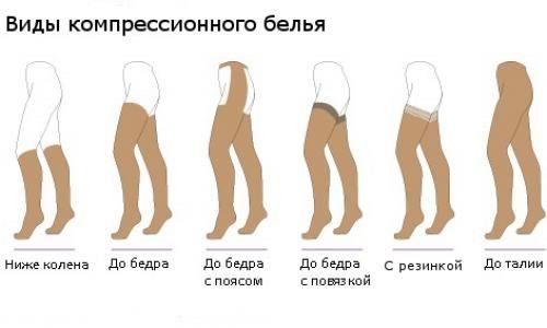 Чулки – красивые, модные, с подтяжками, в сетку, с поясом. Модные бренды, фото чулок на ногах для женщин